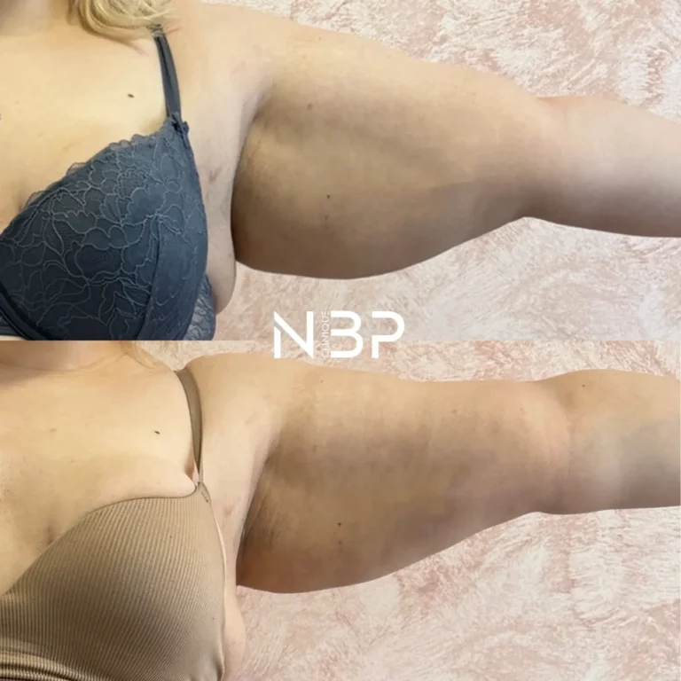 629B1B51-7E57-4885-AE7E-32E7C9BB3711