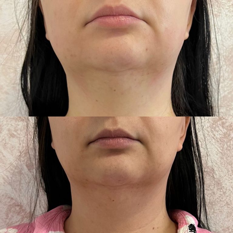 3F062986-6C30-4010-83B8-0AE0ED9341AA